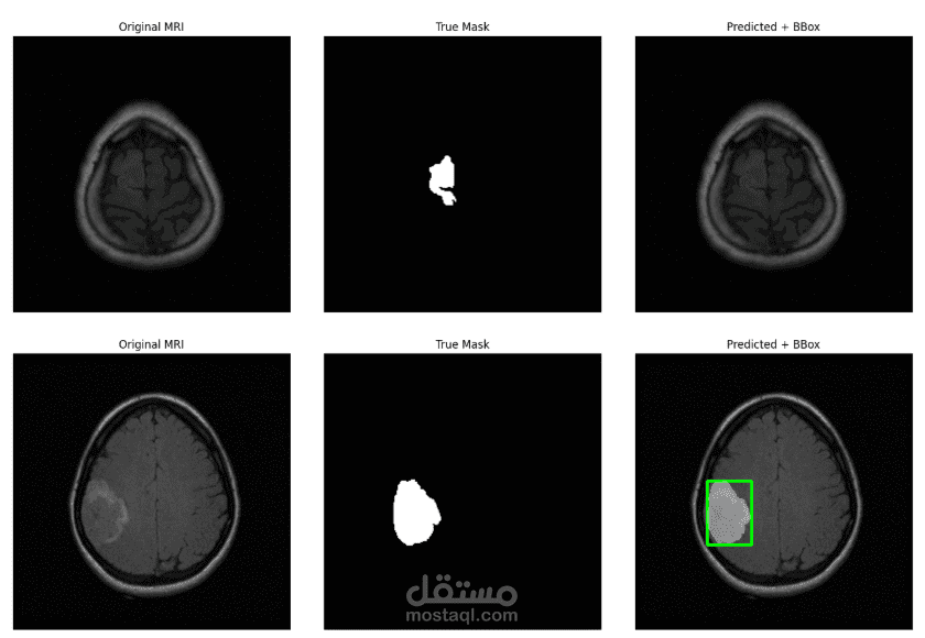 موذج ذكاء اصطناعي للكشف عن أورام المخ وتحديد مكانها بدقة (Brain Tumor Segmentation)
