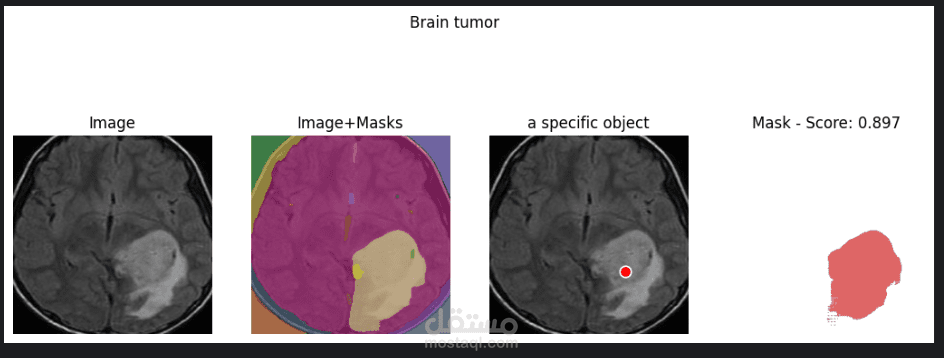 Segment Tumor Using SAM