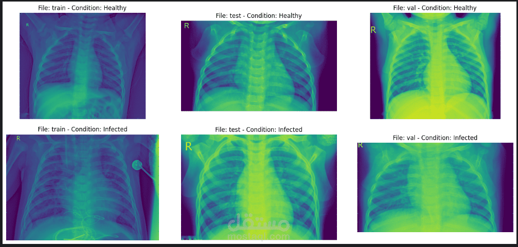 Chest_Xray_model_CNN