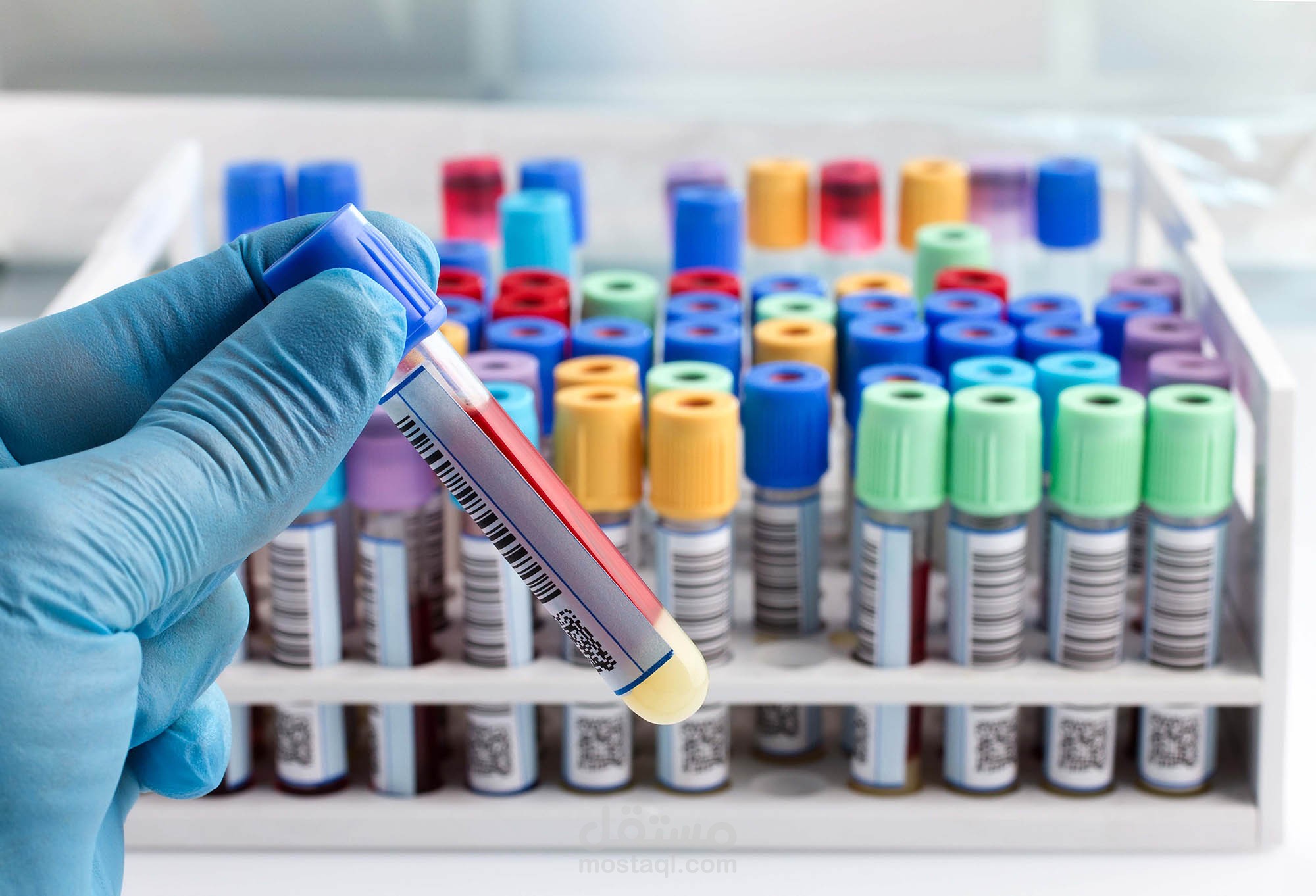 lab tests analysis