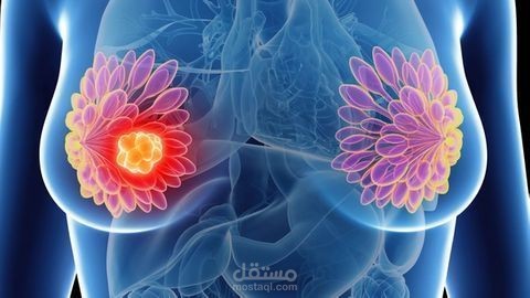 مشروع الكشف عن سرطان الثدي باستخدام تعلم الآلة