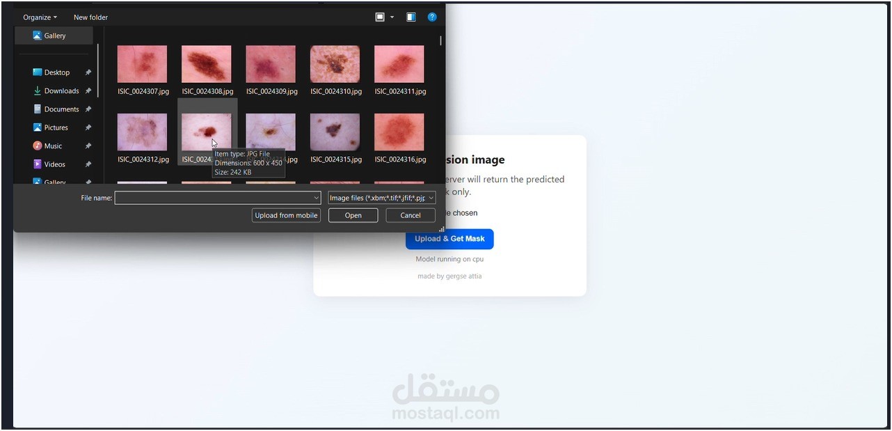 نظام ذكي لتحليل وتجزئة صور الآفات الجلدية باستخدام التعلم العميق (Medical Image Segmentation)