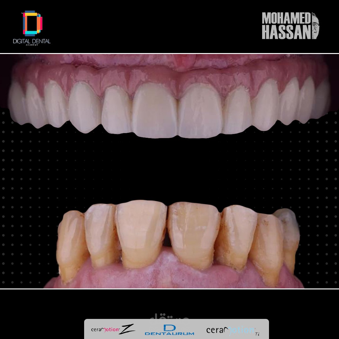 مصمم (power point)لدي(Digital Dental Acadmy)