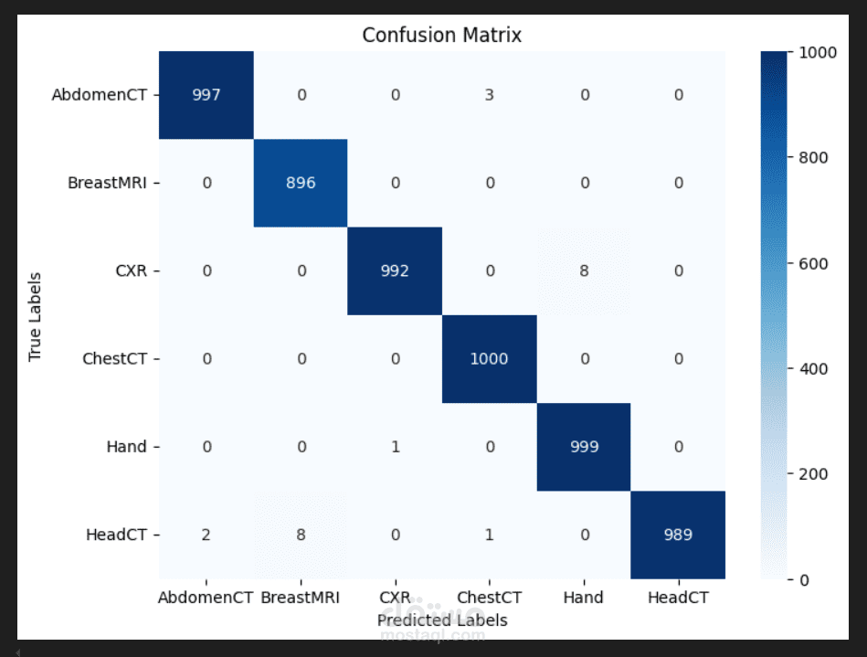 تطبيق الشبكات العصبية التلافيفية CNN لتحليل تصنيف بيانات التصوير الطبي باستخدام بايثون Python
