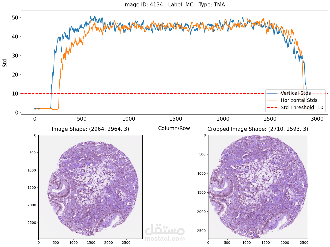 UBC-Ocean: Ovarian Cancer Subtype Classification