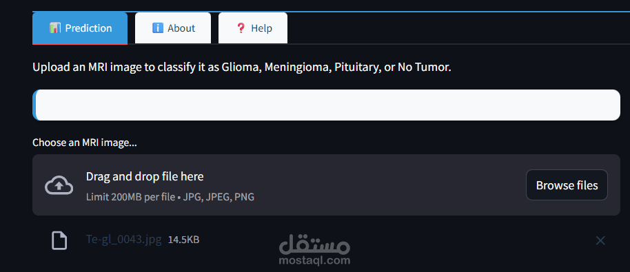 تصنيف اورام الدماغ