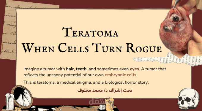عرض تقديمي تفاعلي حول الورم العجائبي (Teratoma) – رؤية طبية شيقة ومبسطة