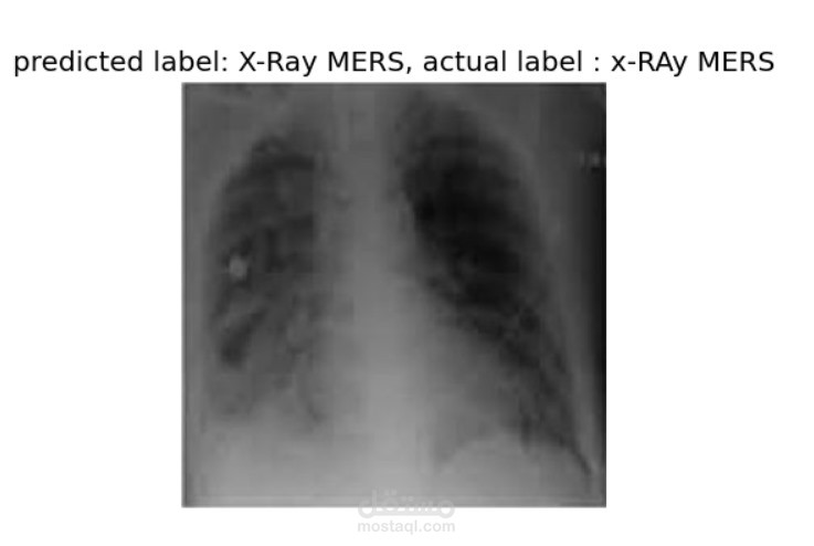 نموذج ذكاء اصطناعي لتشخيص متلازمة الشرق الأوسط التنفسية (MERS) باستخدام الأشعة السينية.