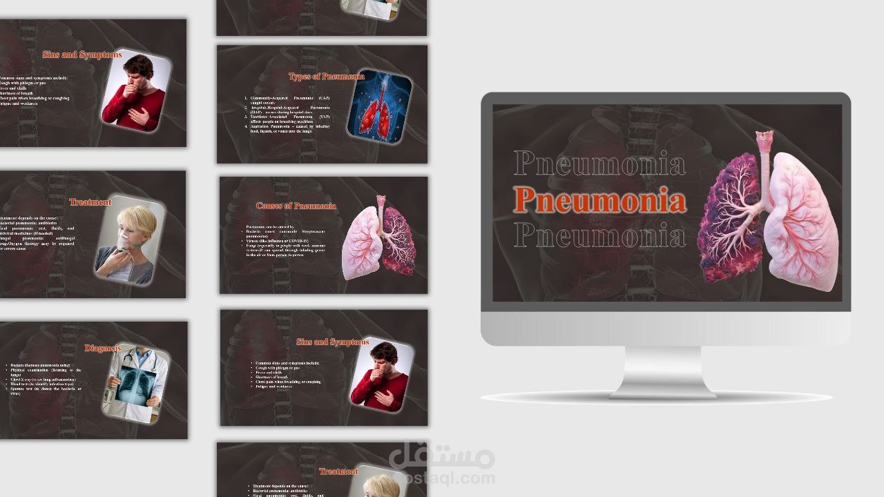 Medical Presentation Design | عرض تقديمي طبي
