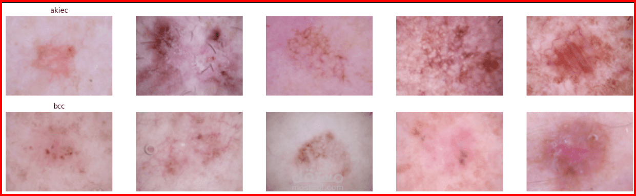 A Robust Skin Cancer Classification using Deep Learning
