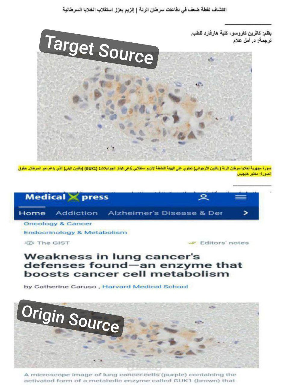 ترجمة طبية لمقال طبي منشور على موقع "ميدكال إكسبريس"