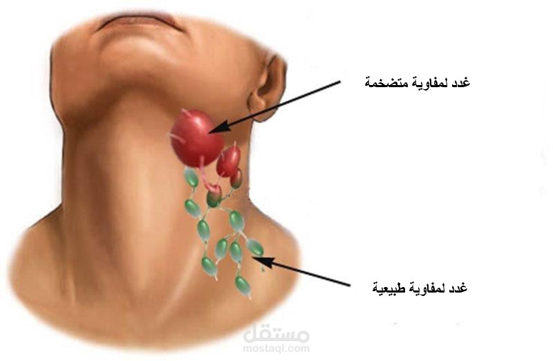 الغدد اللمفاوية