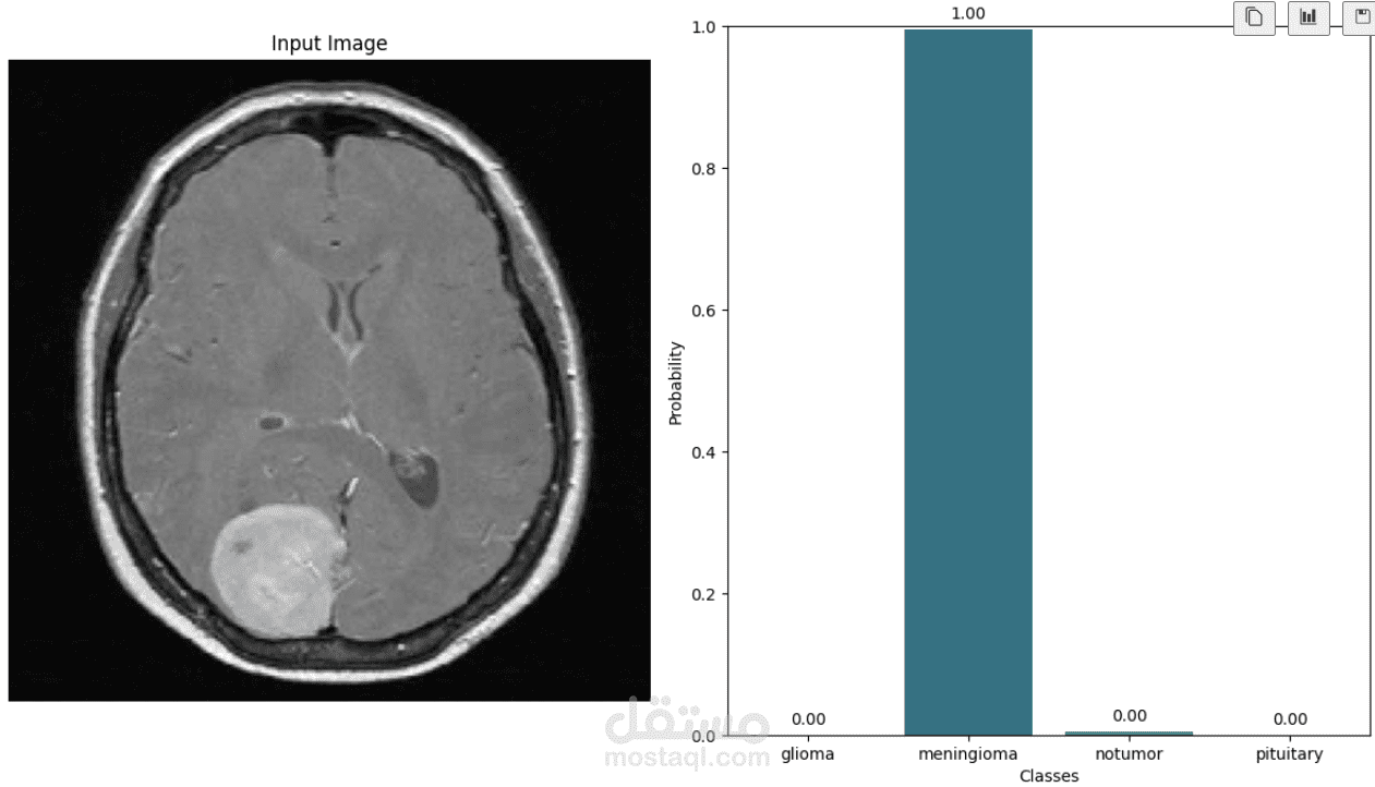 Brain Tumor Classification CNN