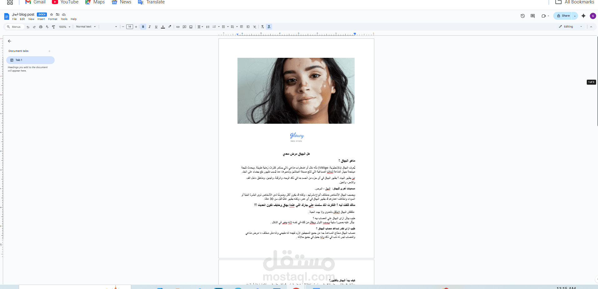 كتابة مدونة عن البهاق