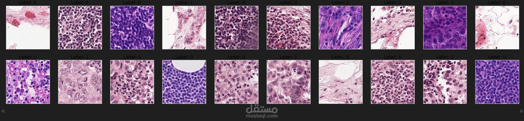 Histopathologic Cancer Detection