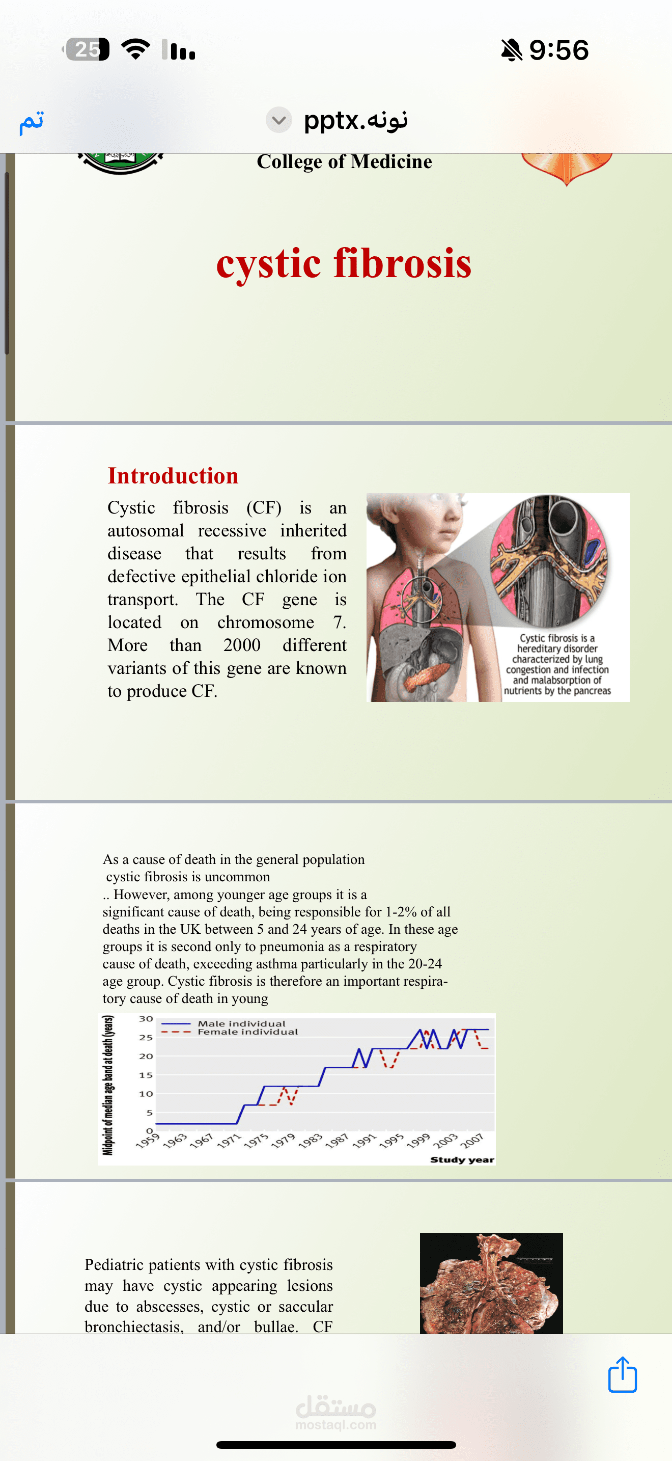 cystic fibrosis