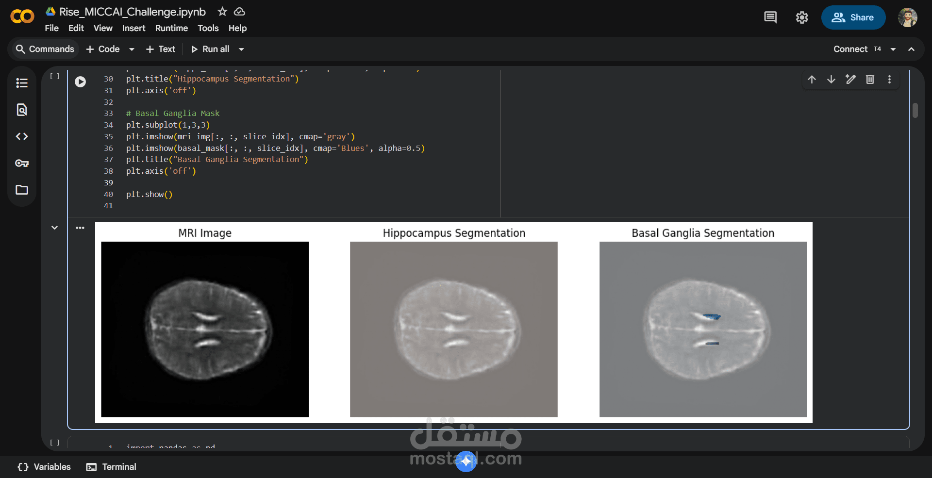 تقسيم الدماغ في صور الرنين المغناطيسي منخفض المجال
