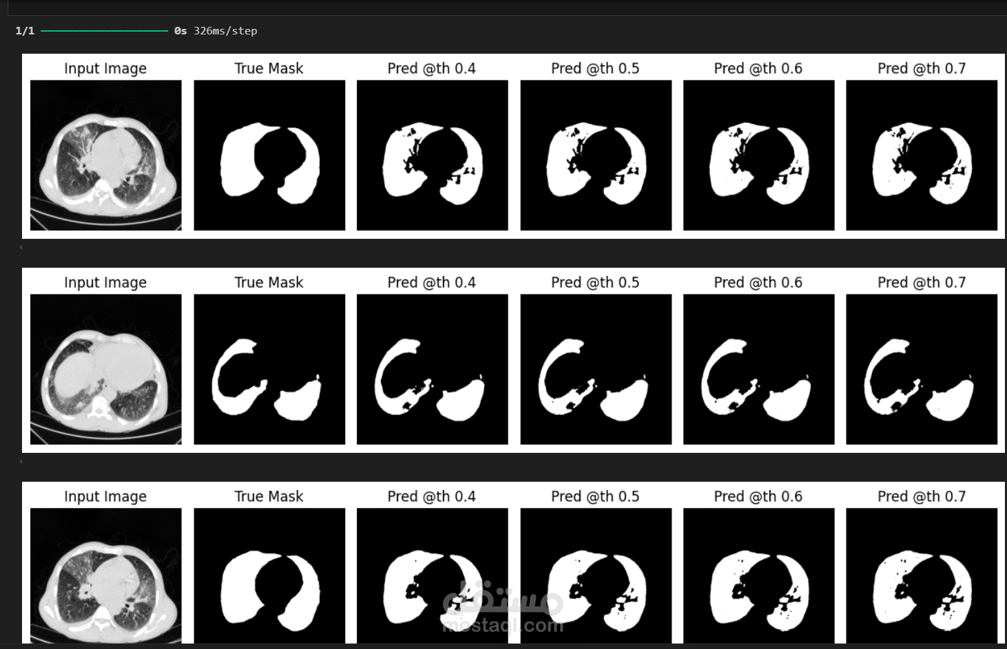 Image segmentation using UNet model