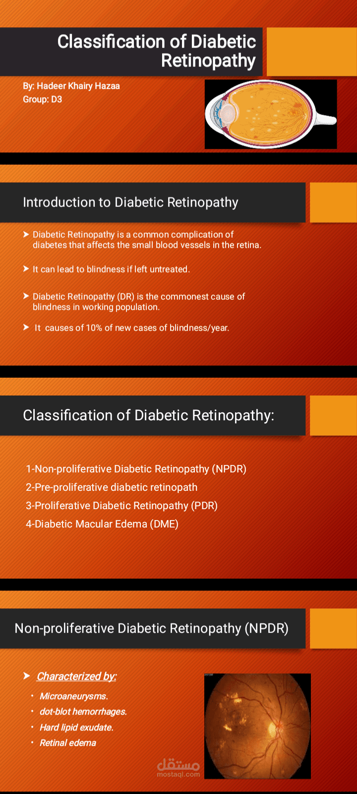 Diabetic Retinopathy
