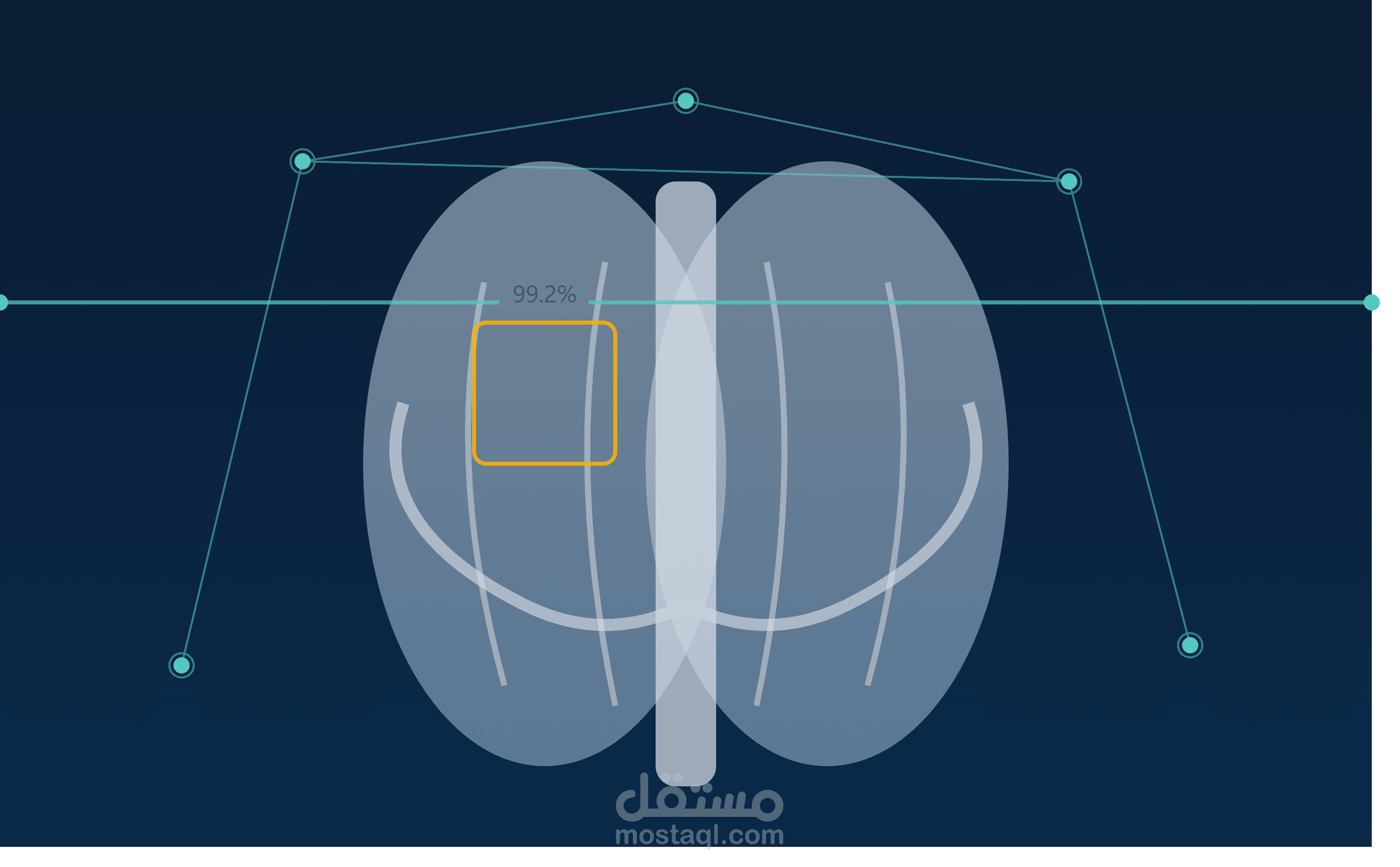 Chest X-Ray Disease Detection – نظام ذكاء اصطناعي للكشف عن أمراض الصدر من الأشعة