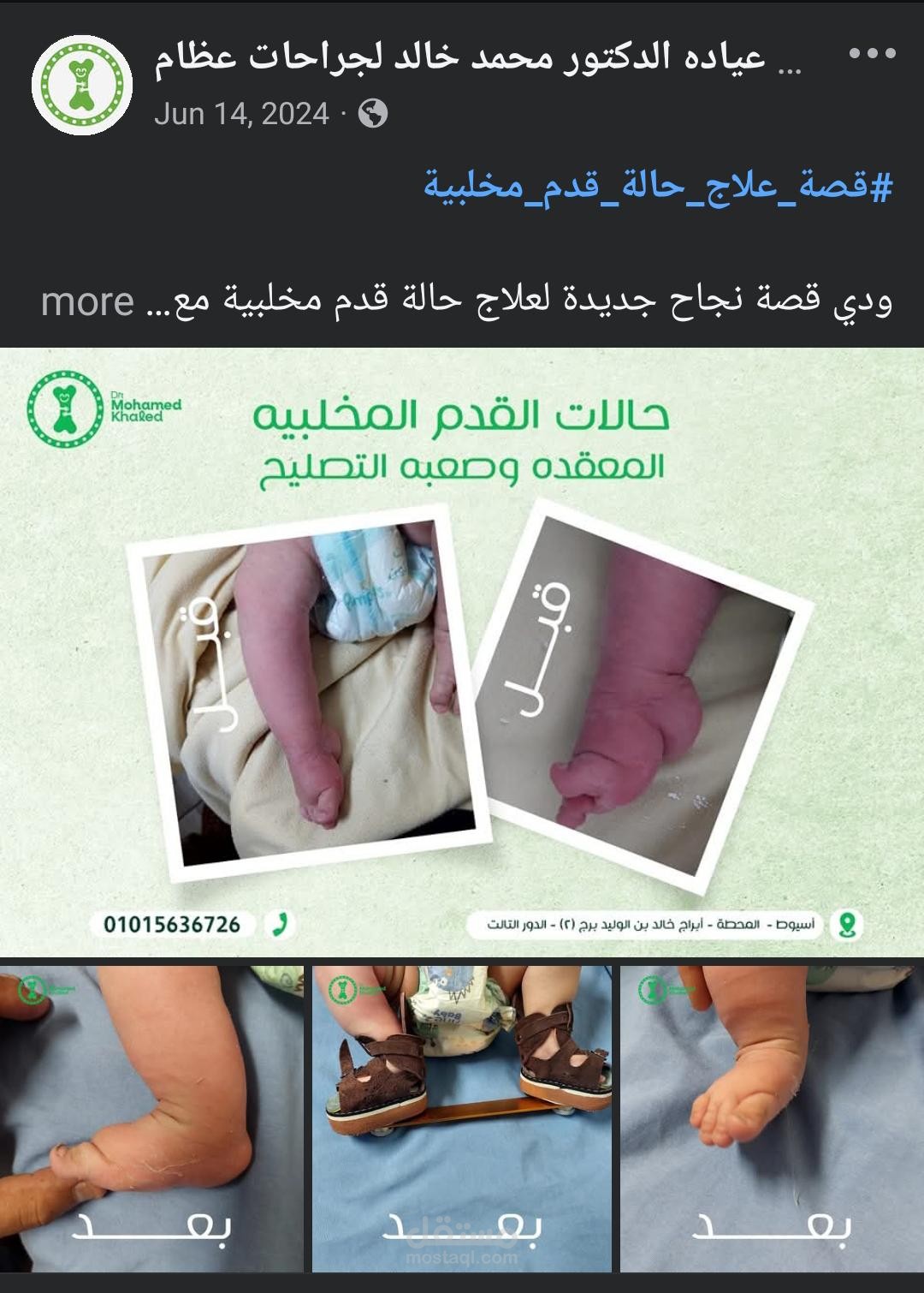 بناء الثقة وزيادة الحجوزات لعيادة جراحات عظام أطفال عبر المحتوى والإعلانات