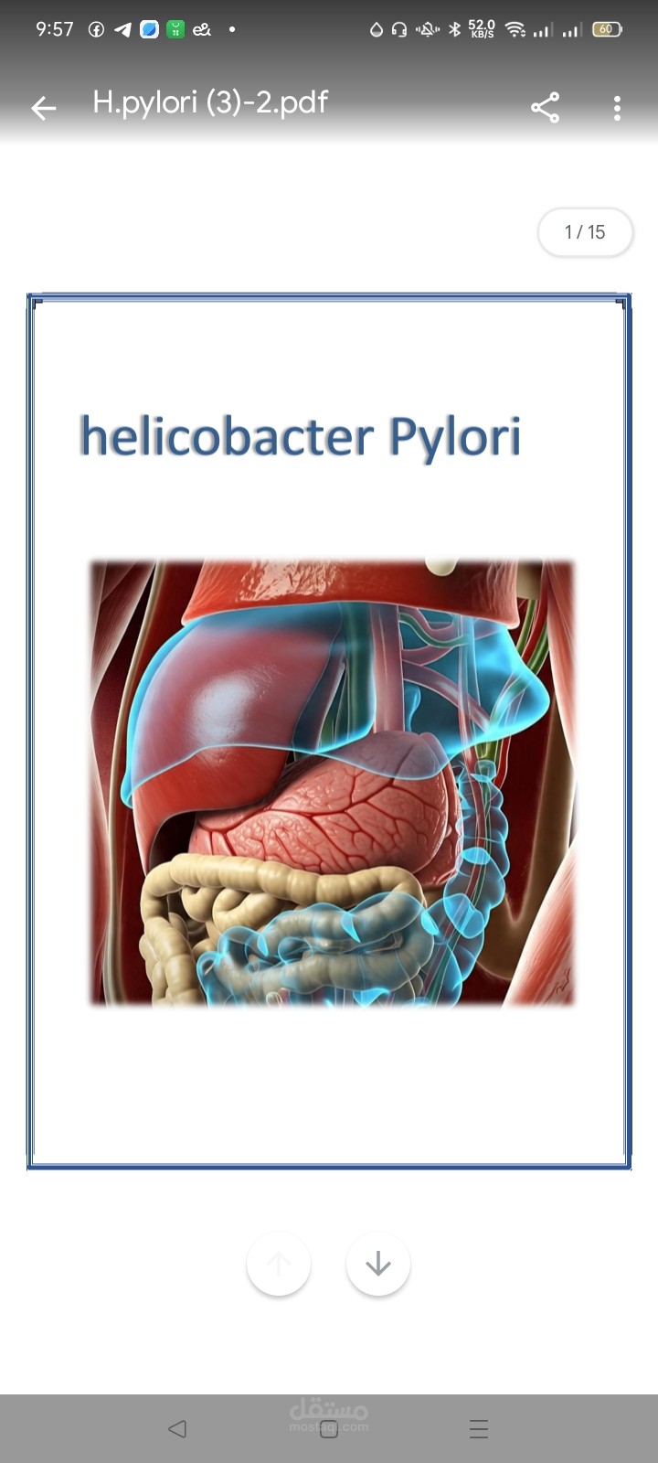 H pylori