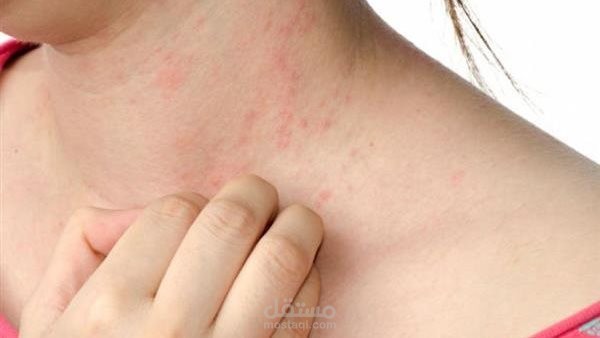 مقالات طبية لمنصة حكيمك دليلك