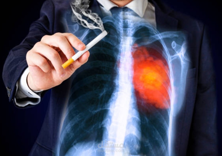 ما هي أضرار التدخين على الإنسان؟ وما هو التدخين السلبي وتأثيره على المحيطين؟
