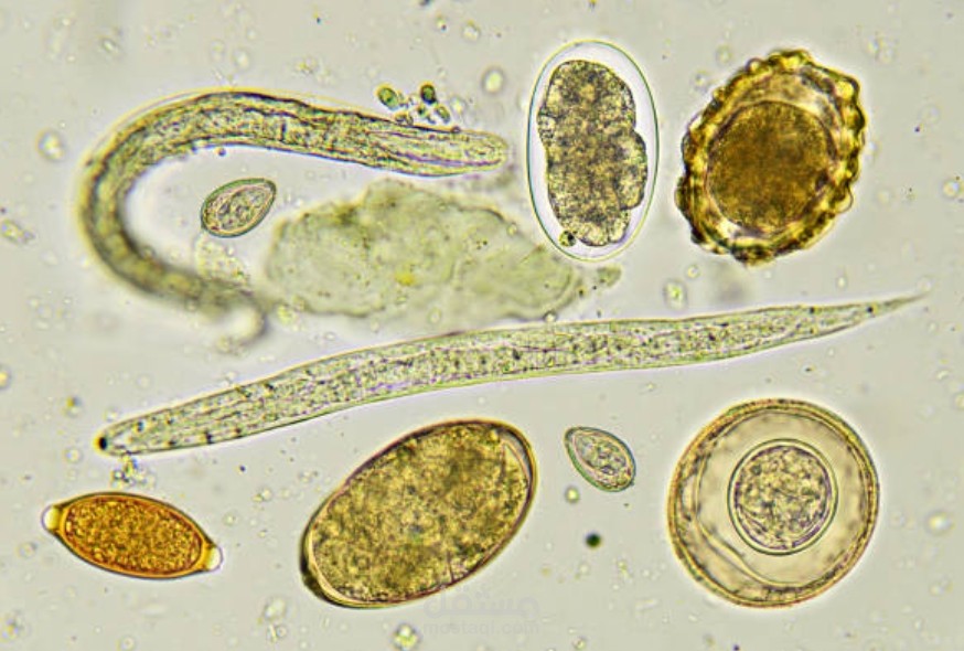 الديدان الطفيلية التي تُصيب الإنسان|كيفية انتقالها| طرق الوقاية منها