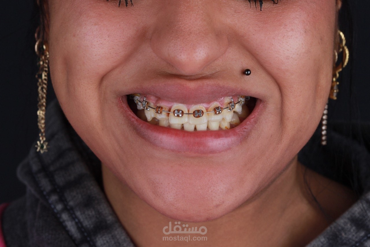 Ortho & Venners | Dental Motion