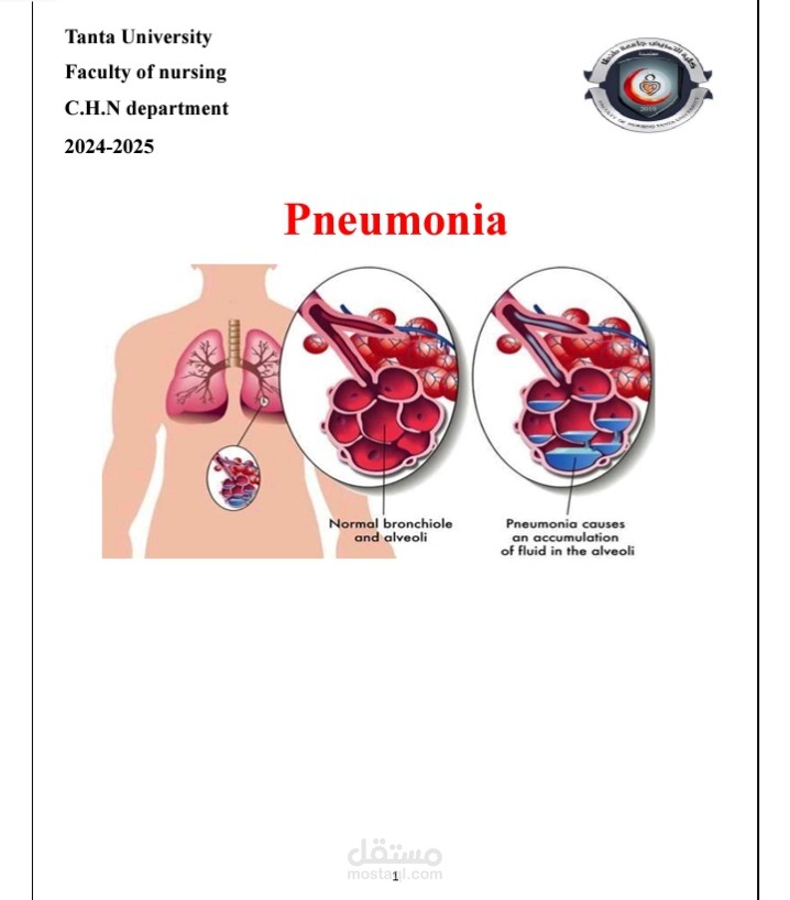 Pneumonia