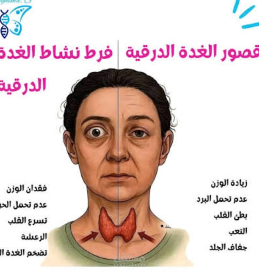 إستئصال الغدة الدرقية
