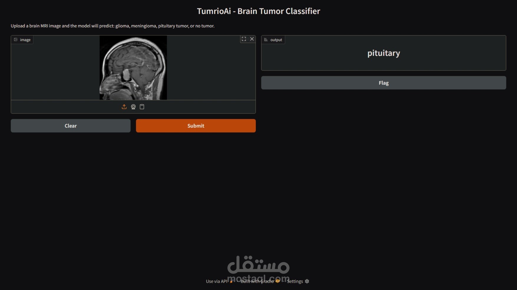 TuMRIoAI - تصنيف أورام الدماغ من صور الرنين المغناطيسي باستخدام الذكاء الاصطناعني