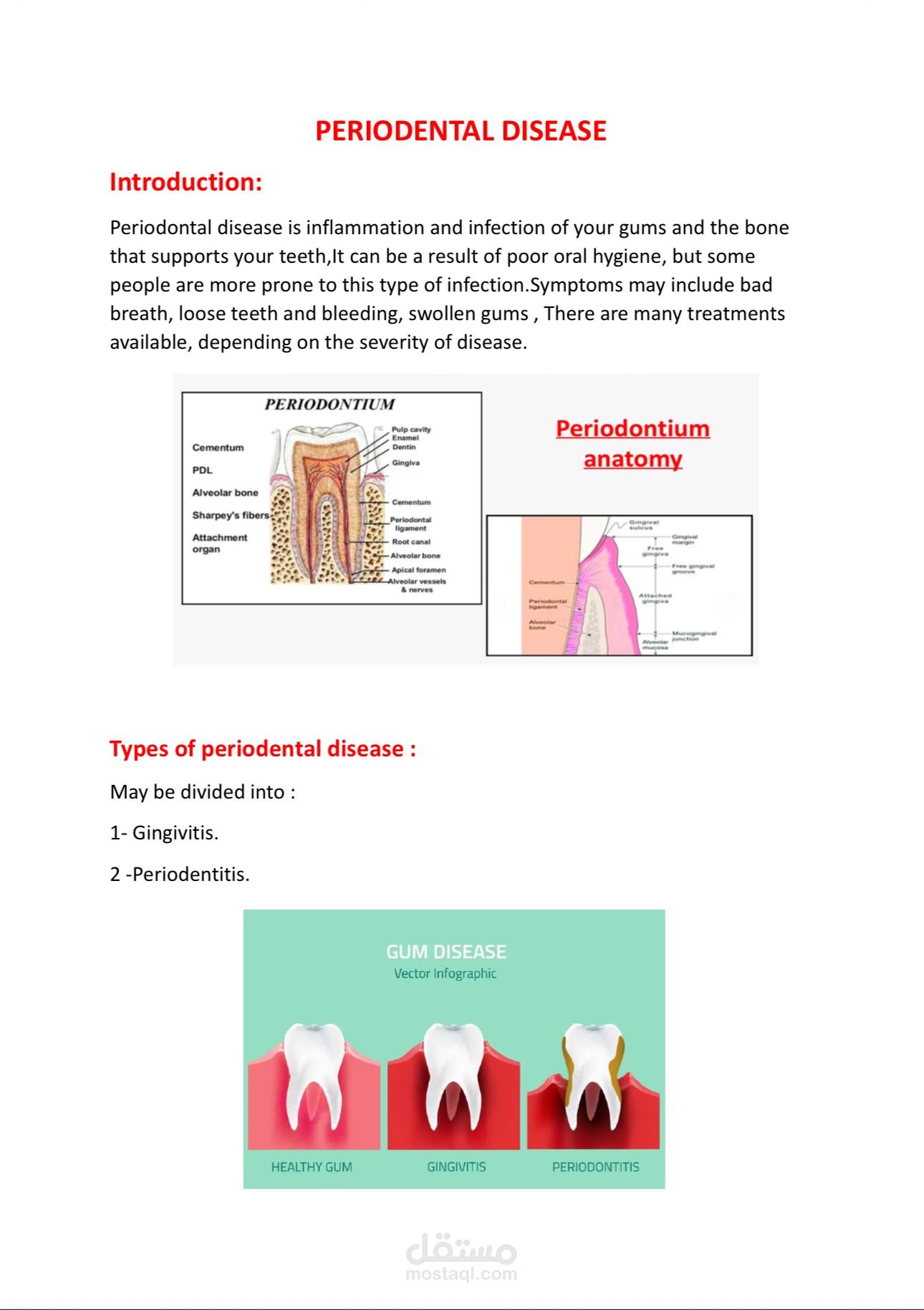 Periodontal diseases  (word >Pdf)
