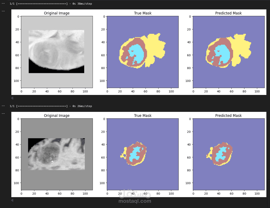 Keras 3d U‑net For Multiclass Brain Tumor Segmentation (4 Classes)