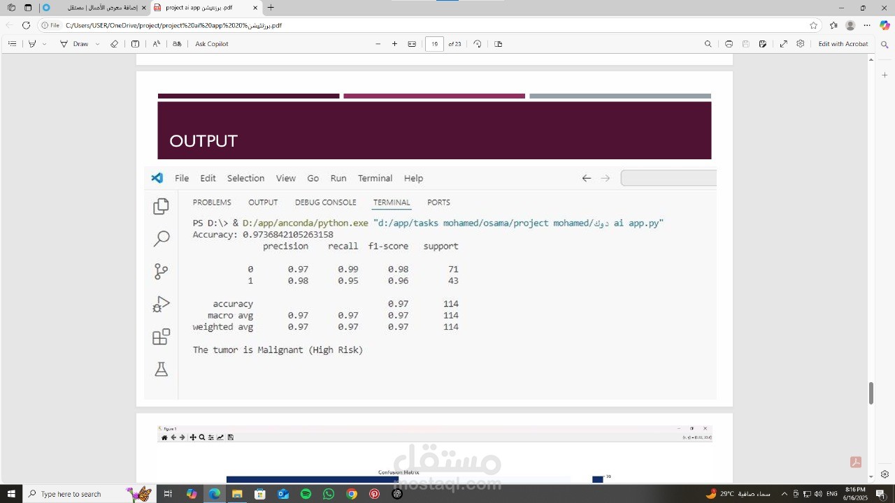 تنبوء بي و تصنيف مرض السرطان