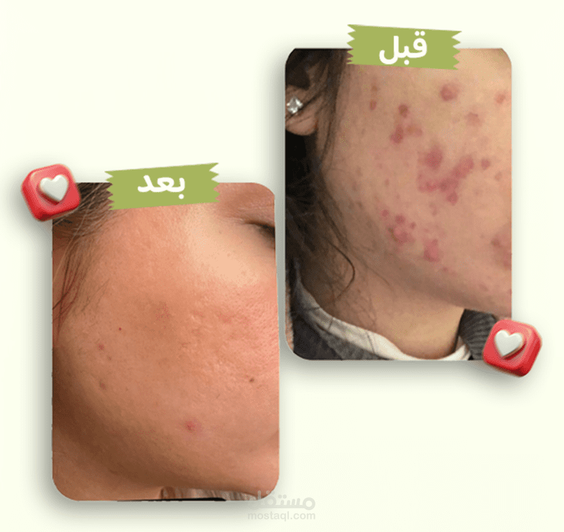 بريد سلسلة ترحيب