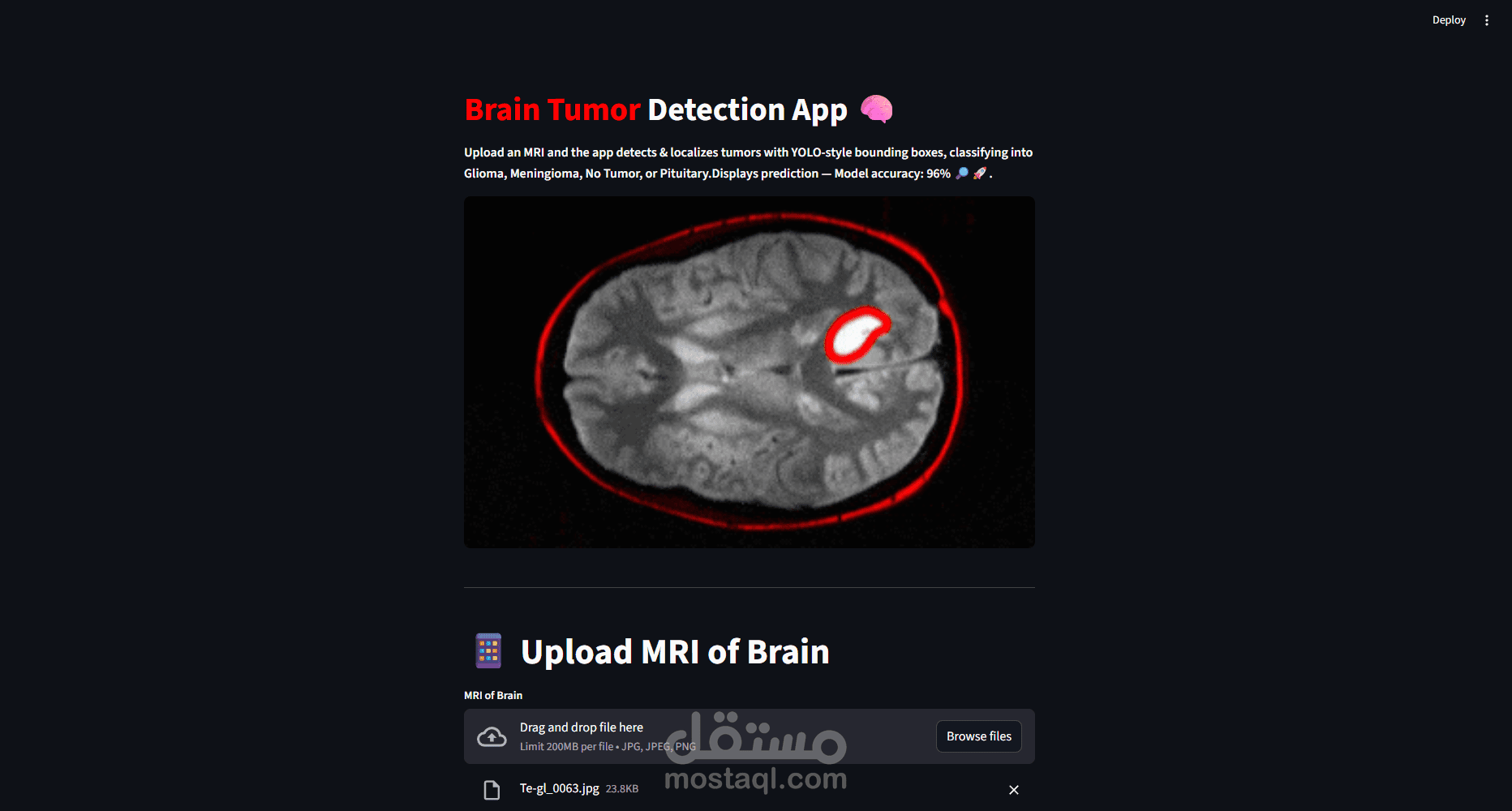 Brain Tumor Detection & Classification with Streamlit (YOLOv8)