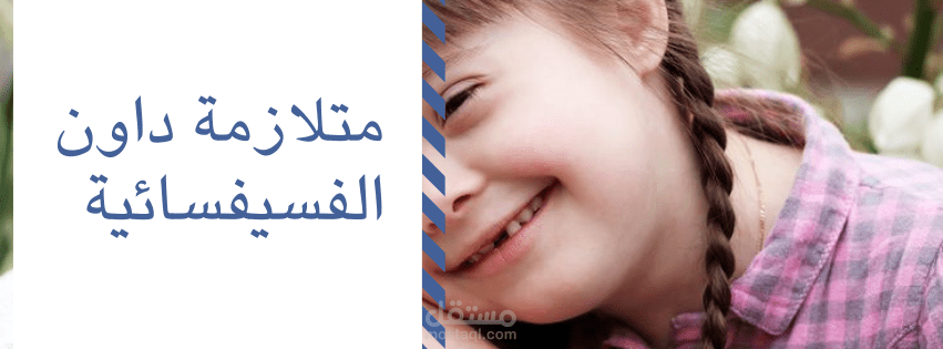 متلازمة داون الفسيفسائية