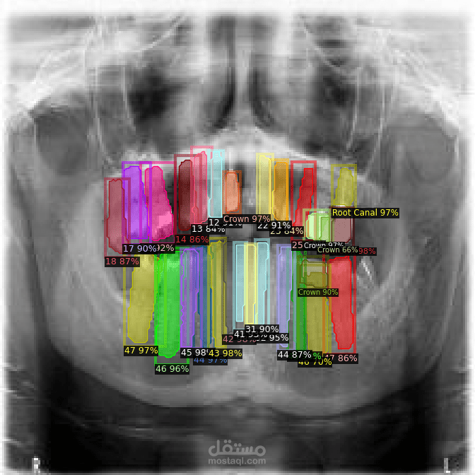 Dentistry instance segmentation
