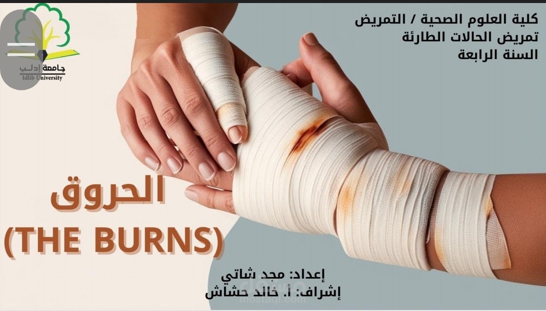 الحروق Burns عرض تقديمي لحالة سريرية عن الحروق