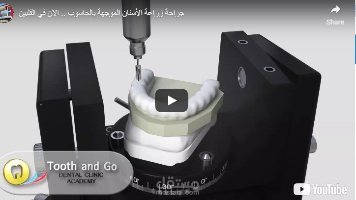 ترجمة فيديو اعلاني في مجال زراعة الاسنان