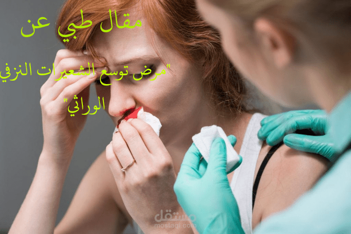 مقال طبي عن "توسع الشعيرات النزفي الوراثي" – الأعراض والتشخيص