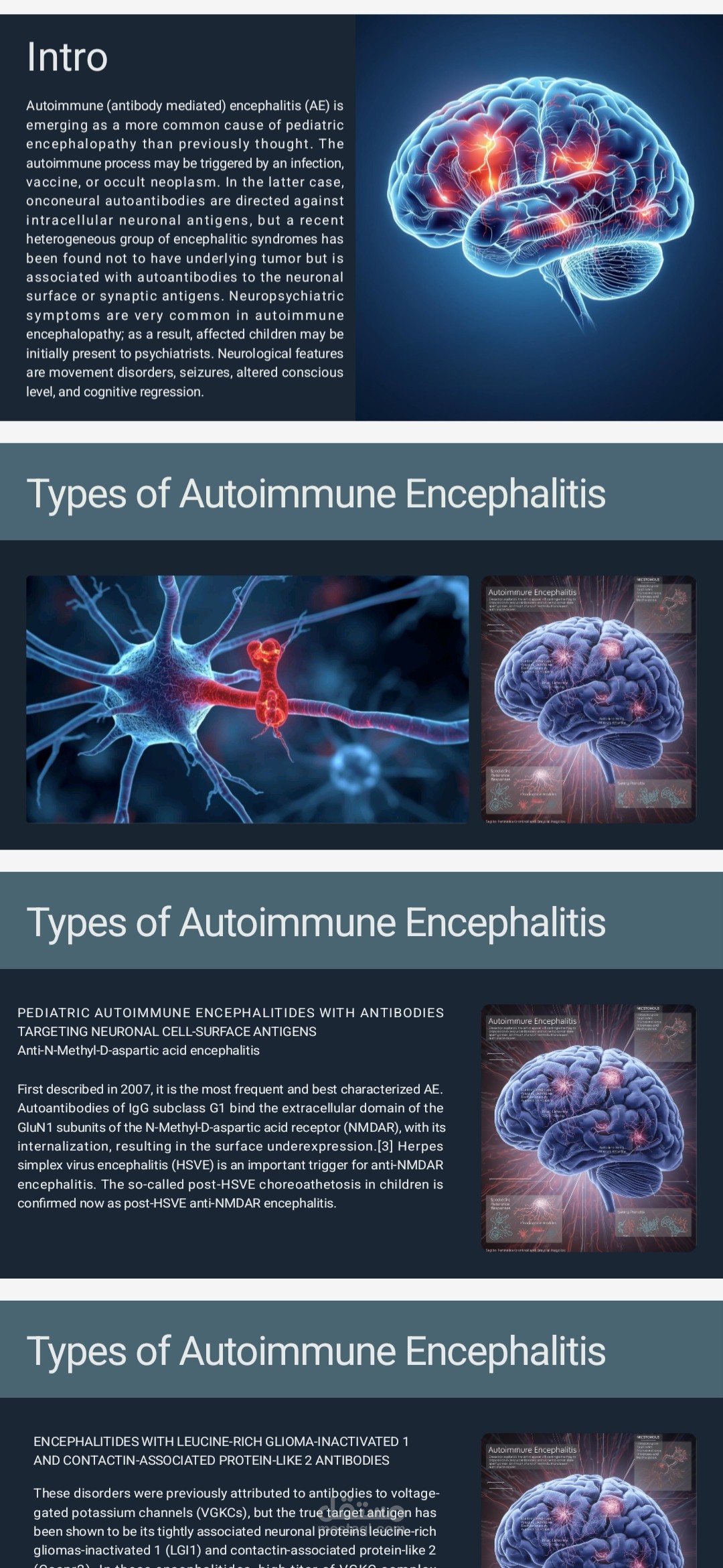 تصميم عرض تقديمي powerpoint لإلتهاب الدماغ المناعي الذاتي لطلاب بجامعة المنصورة