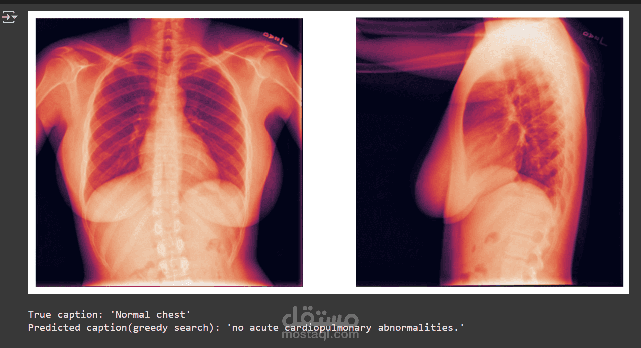 Image Captioning with Deep Learning