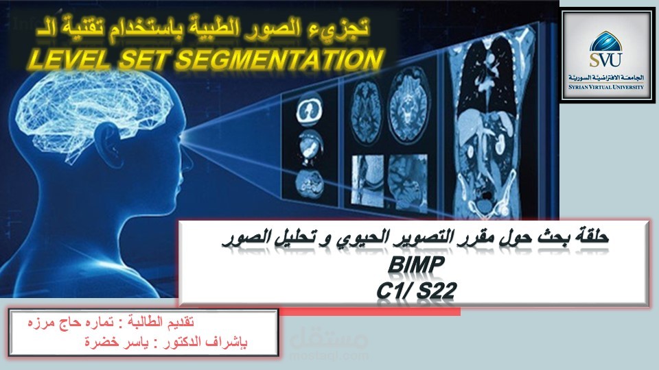 عرض تقديمي بعنوان : تجزيئ الصور الطبية باستخدام تقنية Level Set Segmentation