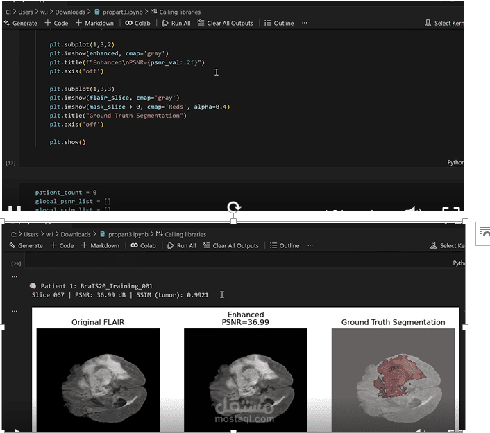 Brain Tumor Segmentation Using Deep Learning (BraTS2020)
