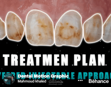 Porcelain dreams, Composite reality A minimally invasive smile revival, dental motion graphic