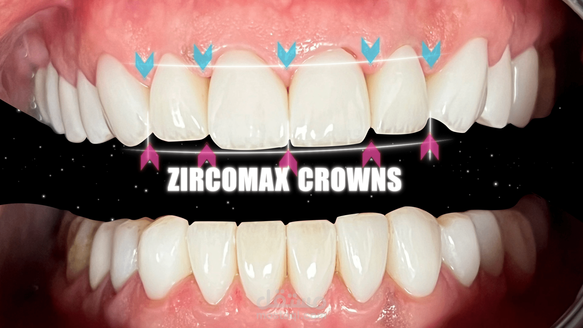 Dental Motion Graphic | Creative Animation For Clinic #dentistry #dentist #dental_motion_graphic