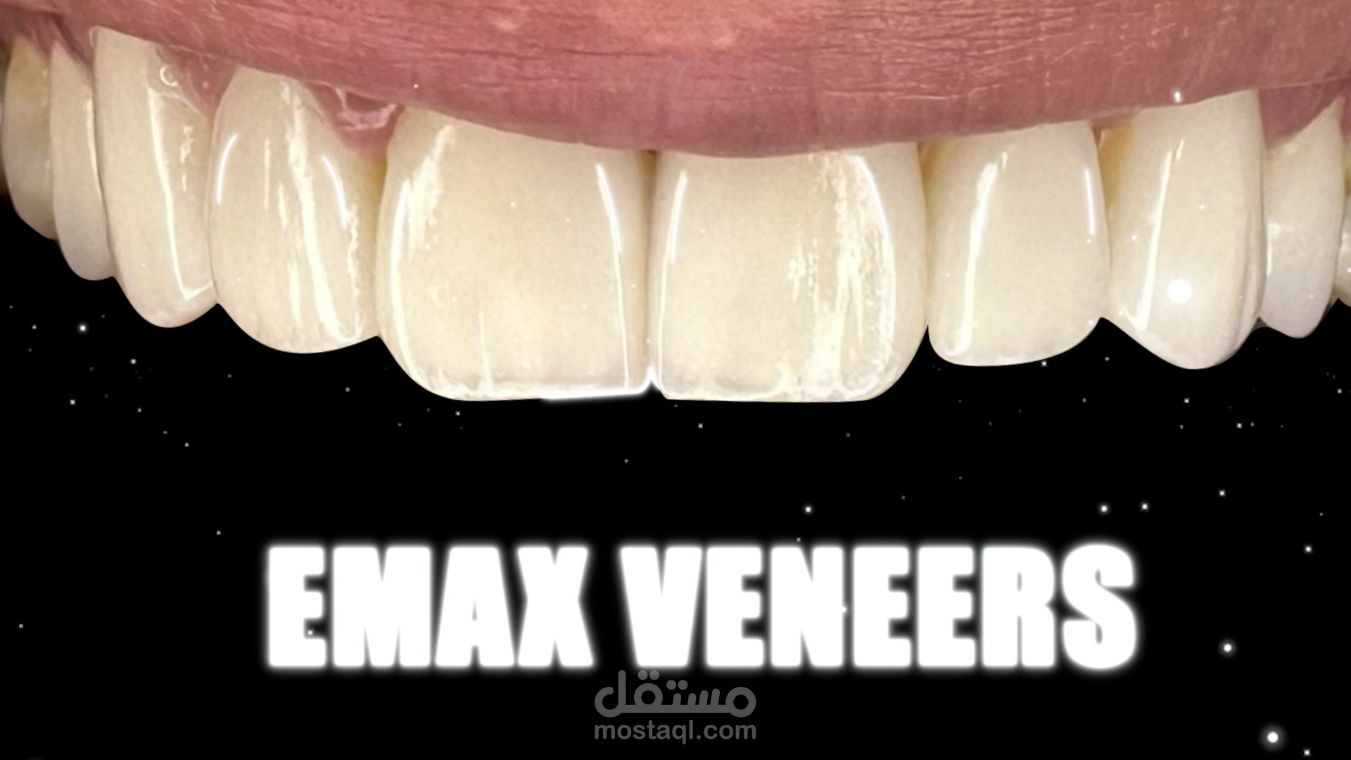 Dental Motion Graphic | Simplifying Smiles with Animation #dentistry #dentist #dental_motion_graphic